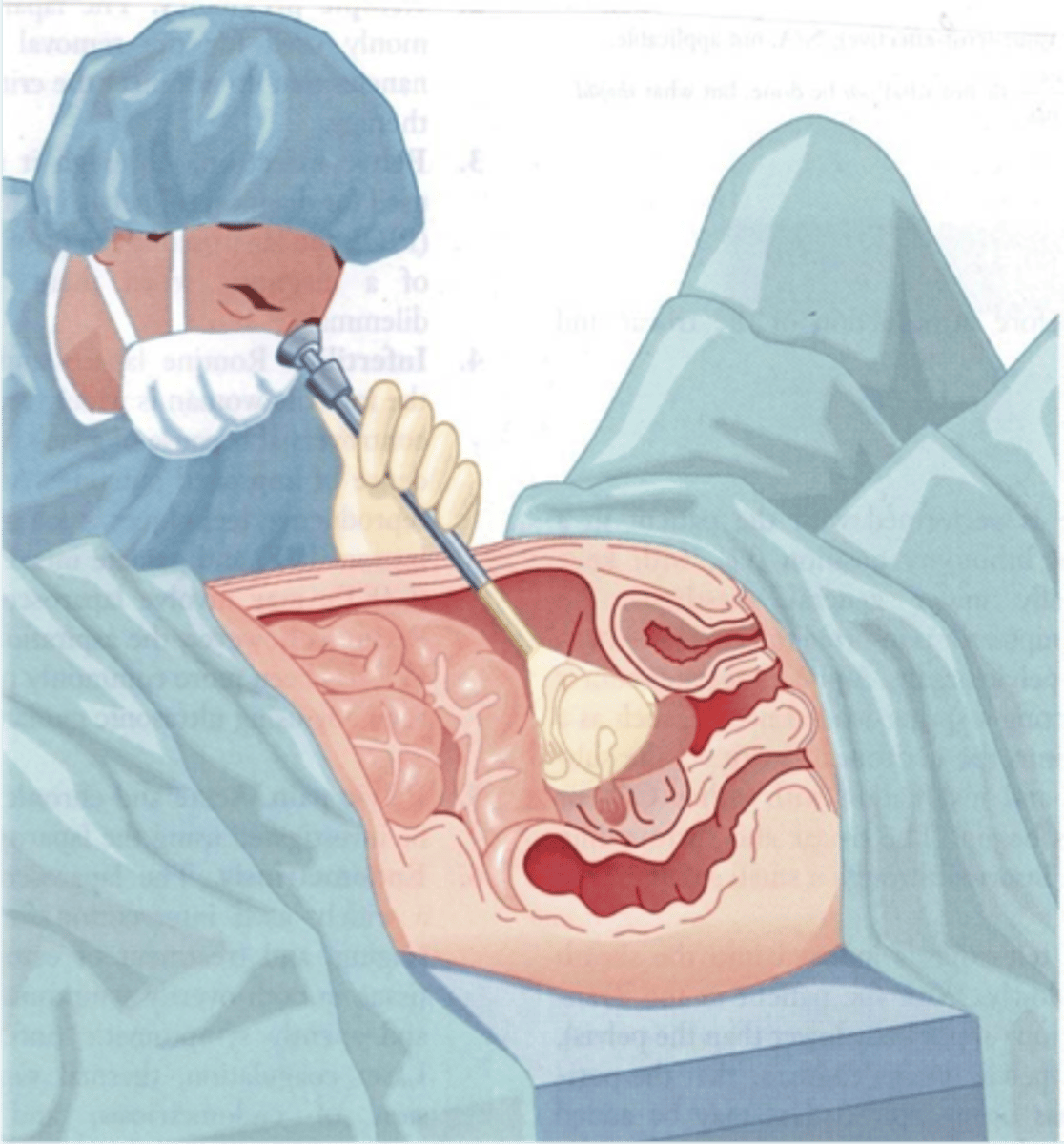 <p>visual exam of abdominal cavity,</p>