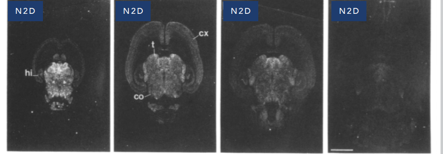 <p>2B, 2D (D basically absent)</p>