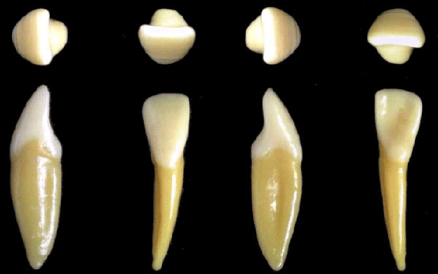 <p>what tooth is this &amp; why?</p>