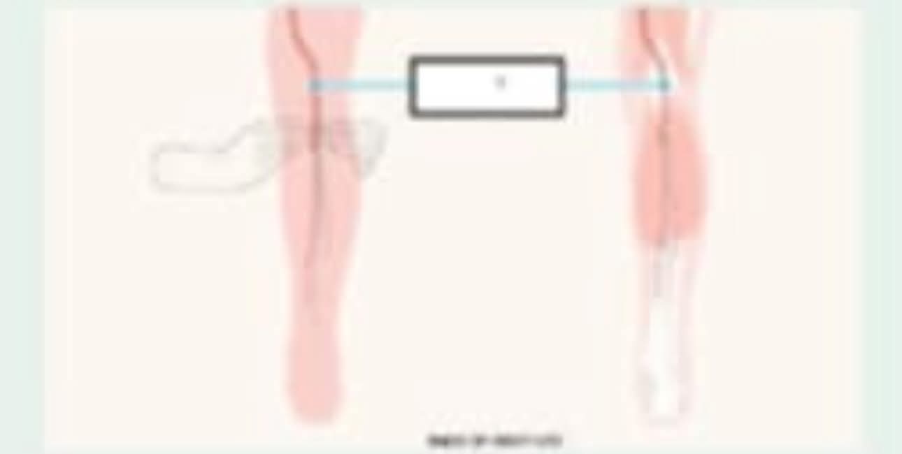 <p>What body part is this?</p>