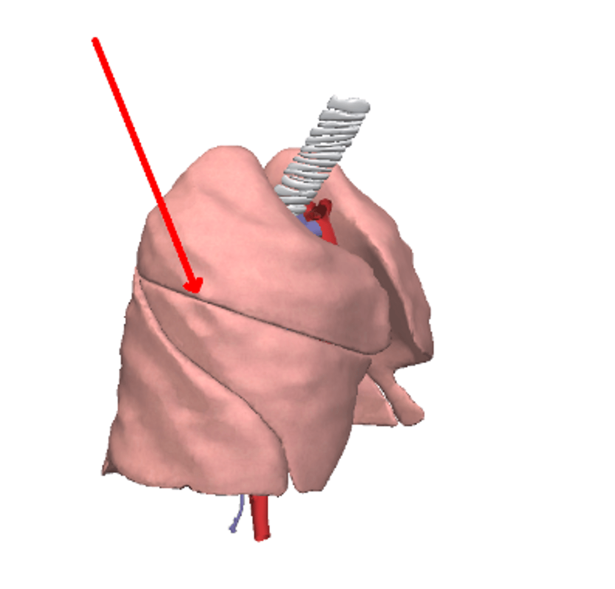 <p>Right horizontal fissure</p>