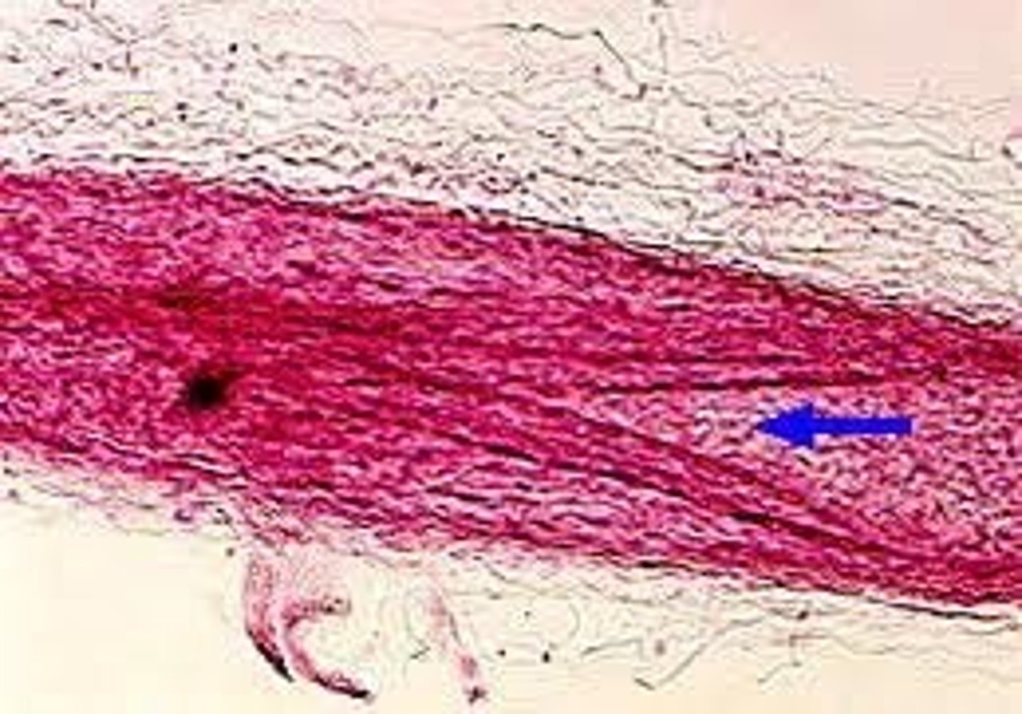 <p>Identify.</p>