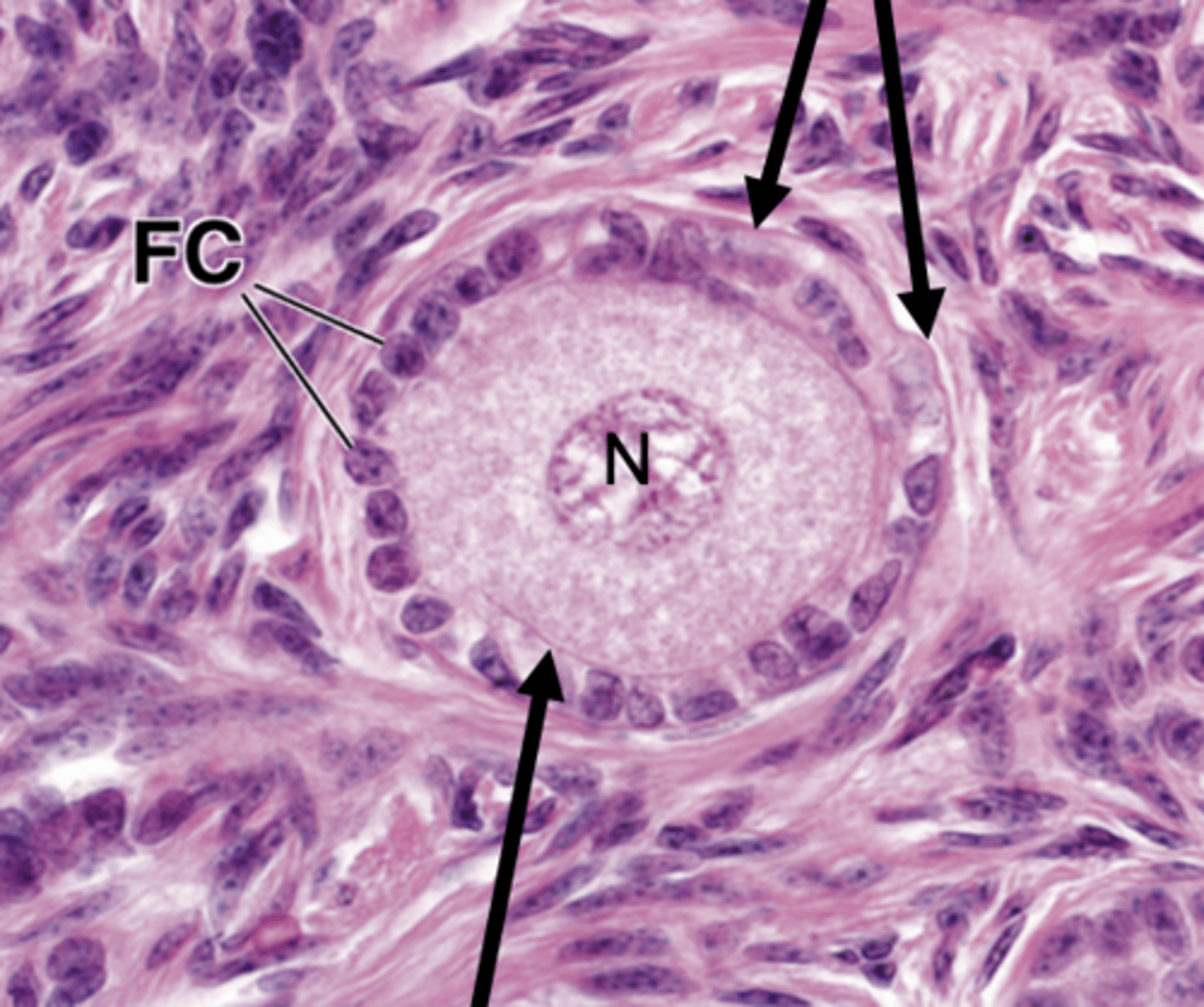<p>What type of follicle is this?</p>