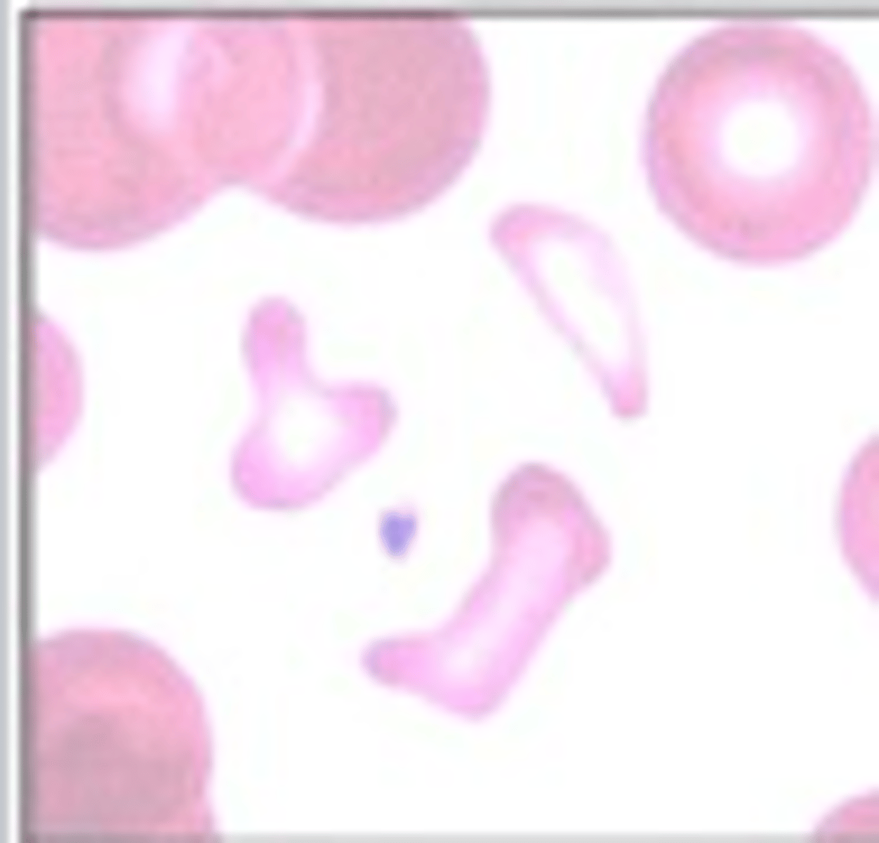 <p>What RBC morphology is this?</p>