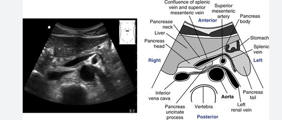 <p>write down the anatomy. </p>