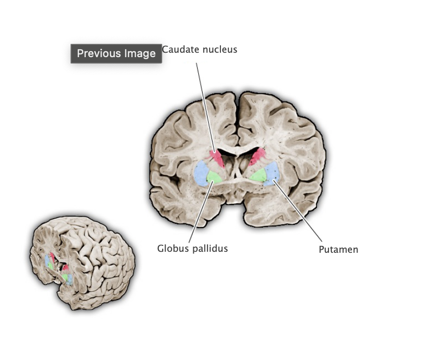 <p>Grey matter structures of the basil ganglia that receive command signals from the cerebral cortex and modulatory signals from dopaminergic neurons in the midbrain; provides phasic inhibitory input to pallidal structures. The striatum comprises two major components, the caudate nucleus and the putamen, plus additional ventral structures, including the nucleus accumbens and the olfactory tubercle.</p>