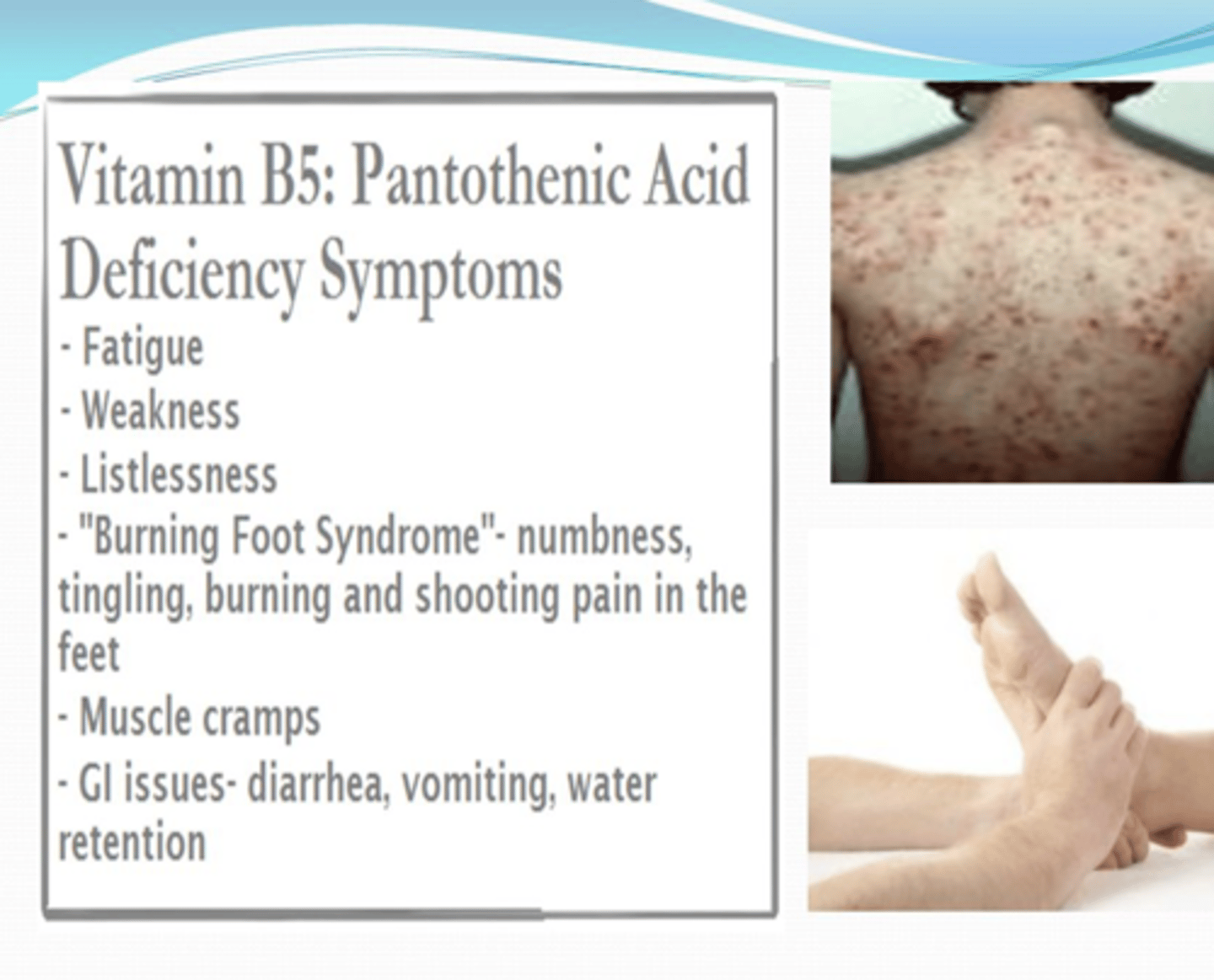 <p>-Very rare; results in dysfunctional lipid synthesis and energy production</p><p>-Depression, fatigue, insomnia, burning sensation in the feet and hands, numb toes and weakness</p>