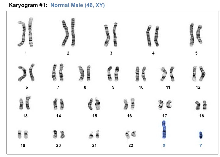 <p>Een ander woord voor karyogram of chromosomenkaart.</p>