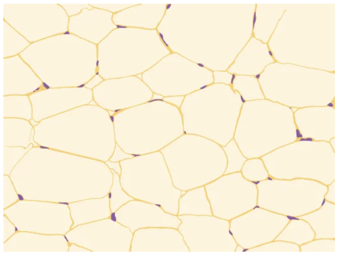 <p>Connective tissue</p><p><strong>Cells:</strong> Adipocytes</p><p><strong>Fibers: </strong>Few</p><p><strong>Location: </strong>Adipose (fat)</p>