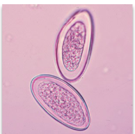 <p>Intestinal parasite, fecal contamination</p>