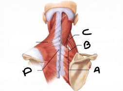 <p>What is the name of this Muscle? (A)</p>