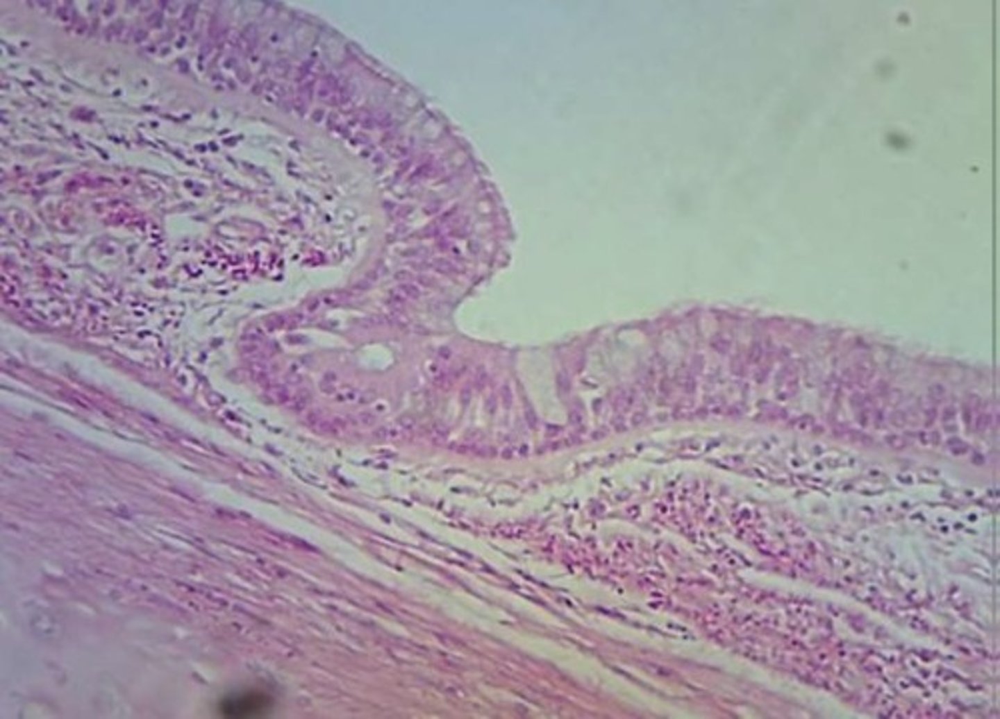 <p>special feature of pseudostratified columnar epithelium</p>