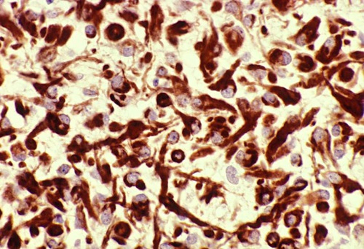 <p>What is the immunohistological stain for Astrocytes?</p>