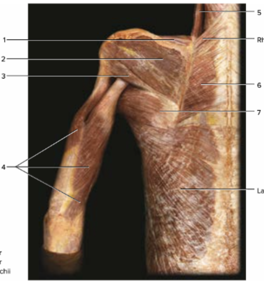 <p>label 1-7. word bank: infraspinatus, levator scapulae, rhomboid major, supraspinatus, teres major, teres minor, triceps brachi </p>