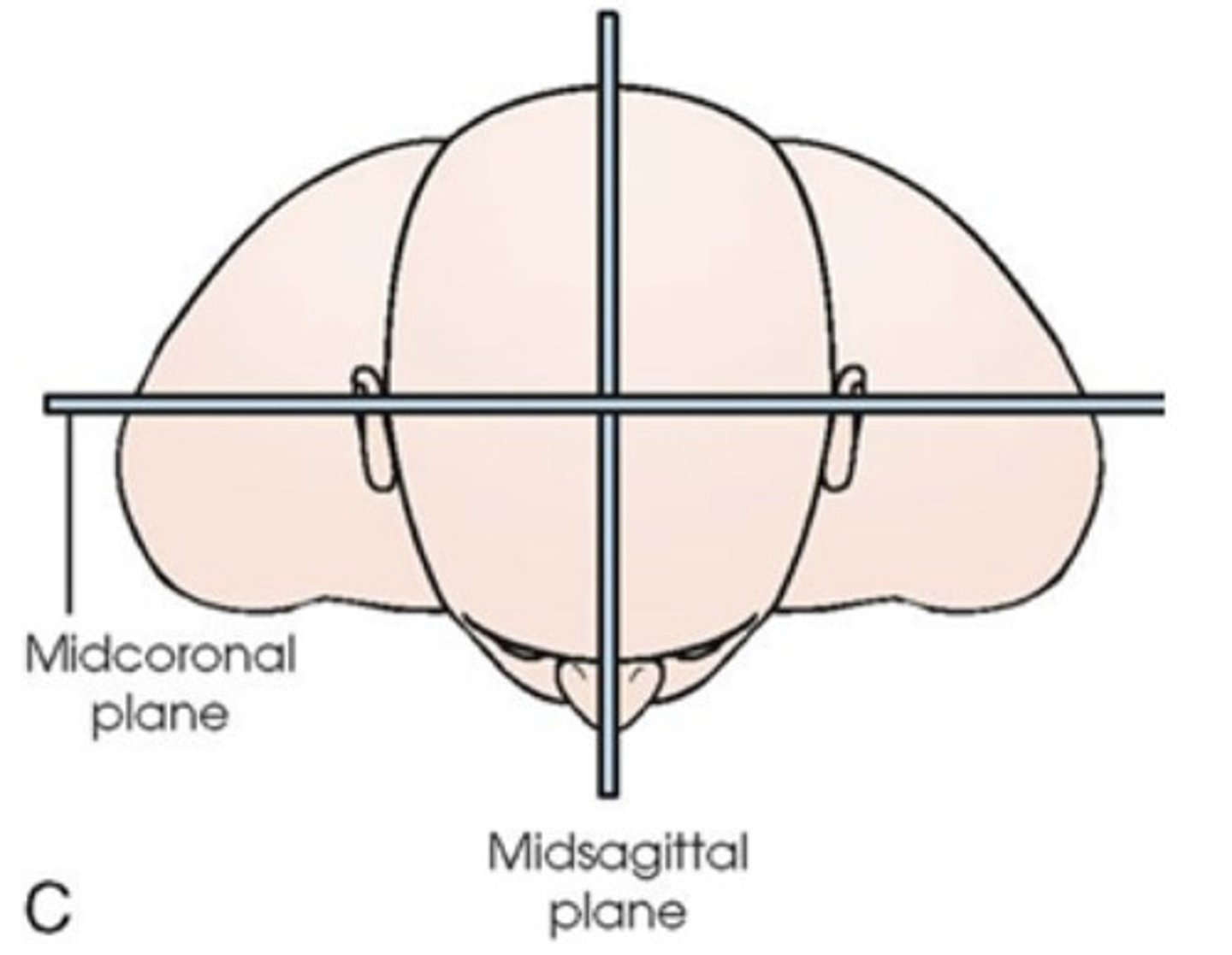 <p>perpendicular to IR (IR is on right side)</p>