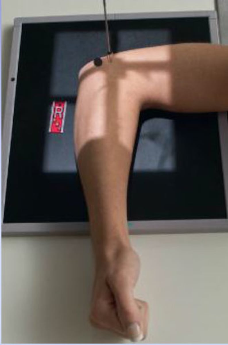 <p>CR perpendicular to mid elbow joint (4 cm medial to palpable posterior surface of olecranon process)</p>