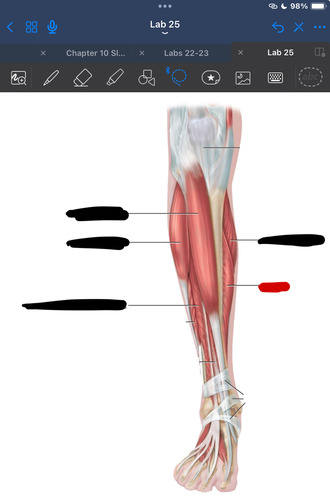 <p>What muscle is this?</p>