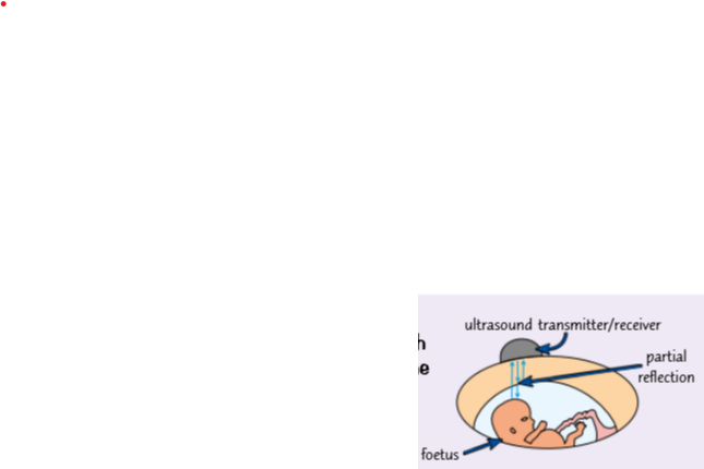 <ul><li><p>Ultrasound waves can pass through the body, but whenever they reach a boundary between two different media (like fluid in the womb and the skin of the foetus) some of the wave is reflected back and detected.</p></li><li><p>The exact timing and distribution of these echoes are processed by a computer to produce a video image of the foetus.</p></li><li><p>No one knows for sure if ultrasound is safe in all cases but X-rays would definitely be dangerous.</p></li></ul><p></p>