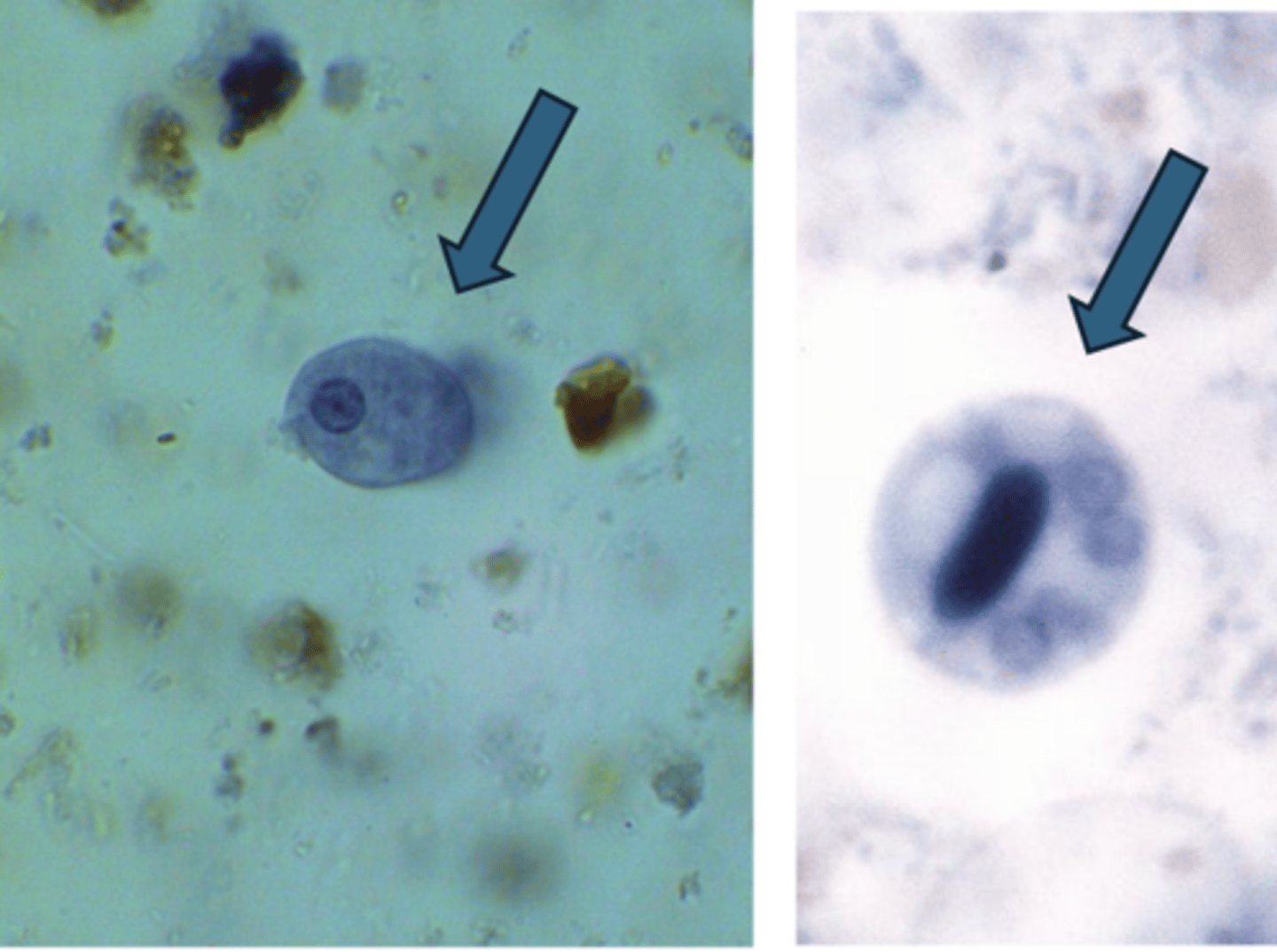 <p>Entamoeba histolytica - (L) cyst (R) trophozoite</p>
