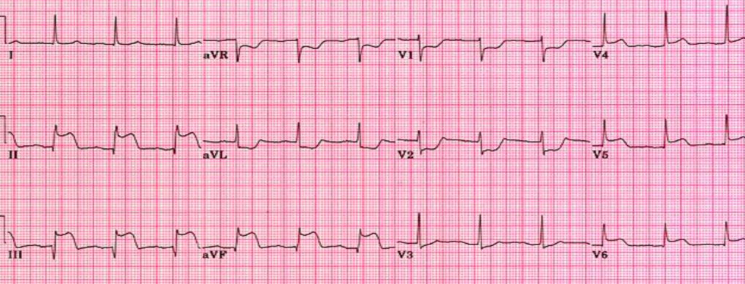 <p>what is this?</p>