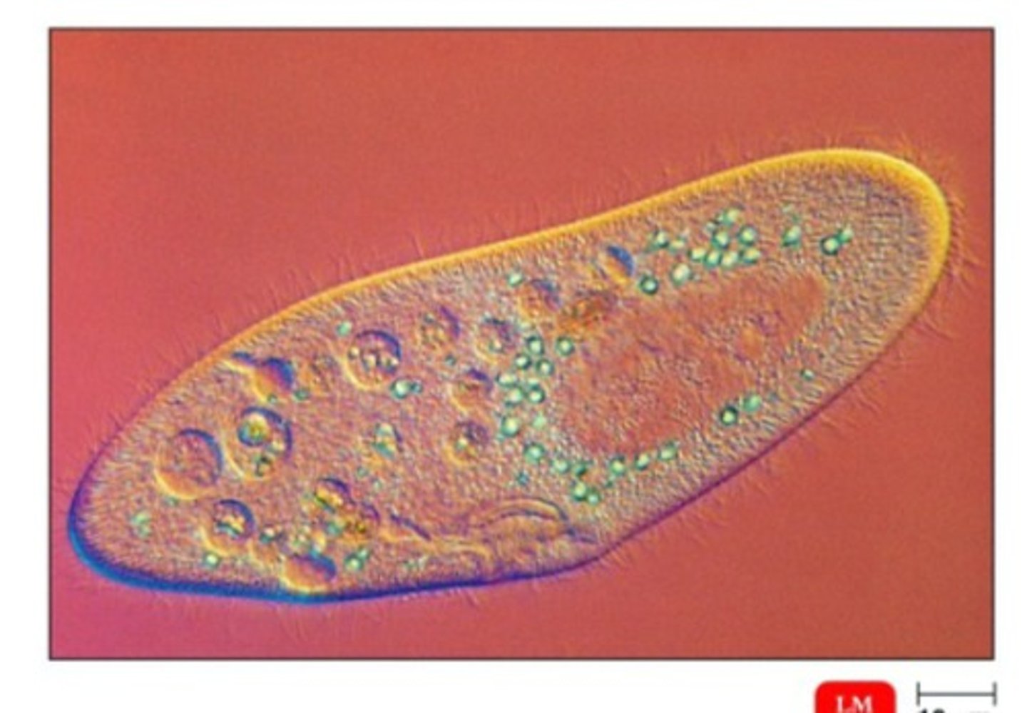 <p>Optical Microscopy used to enhance or create contrast in transparent, unstained organisms.</p>