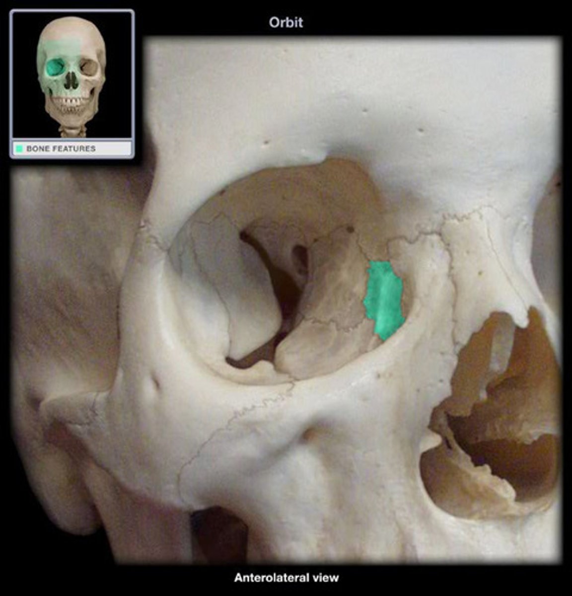 <p>small fragile bone making up part of the front inner walls of each eye socket and providing room for the passage of the lacrimal ducts (tear ducts)</p>