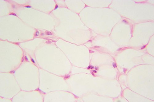 <p>Name this tissue</p>