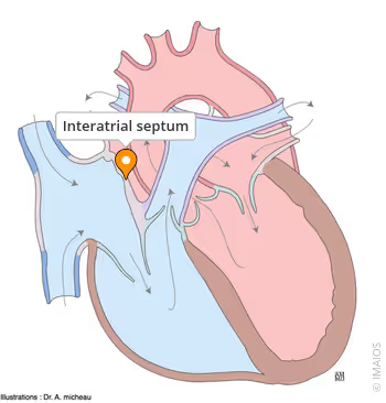 <ul><li><p>modification of amphibian heart from fish heart (adapted to land)</p></li></ul><p>separates right and left atriums</p><ul><li><p>Complete in anurans, some urodeles</p></li><li><p>Absent in lungless urodeles</p></li><li><p><strong>Left atrium</strong> receives <u>oxygenated </u>blood from lungs/swim bladder</p></li><li><p><strong>Right atrium</strong> receives <u>deoxygenated </u>blood from sinus venosus</p></li></ul><p></p>