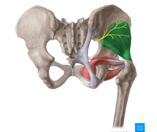 term image
