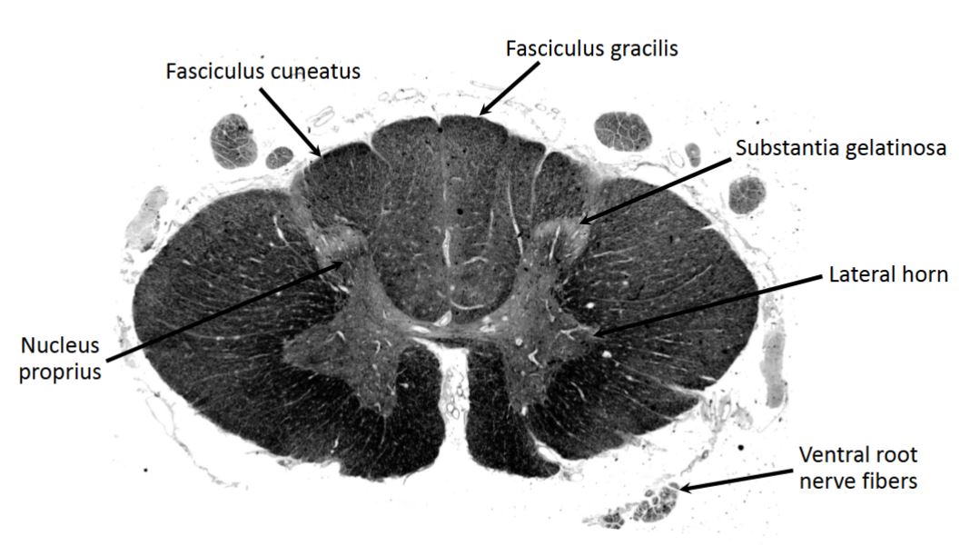 <p>upper thoracic (T2)</p>