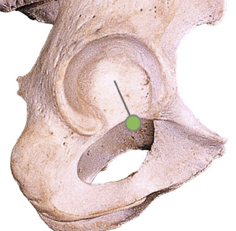 <p>Which part of the hip is the hip socket?</p>