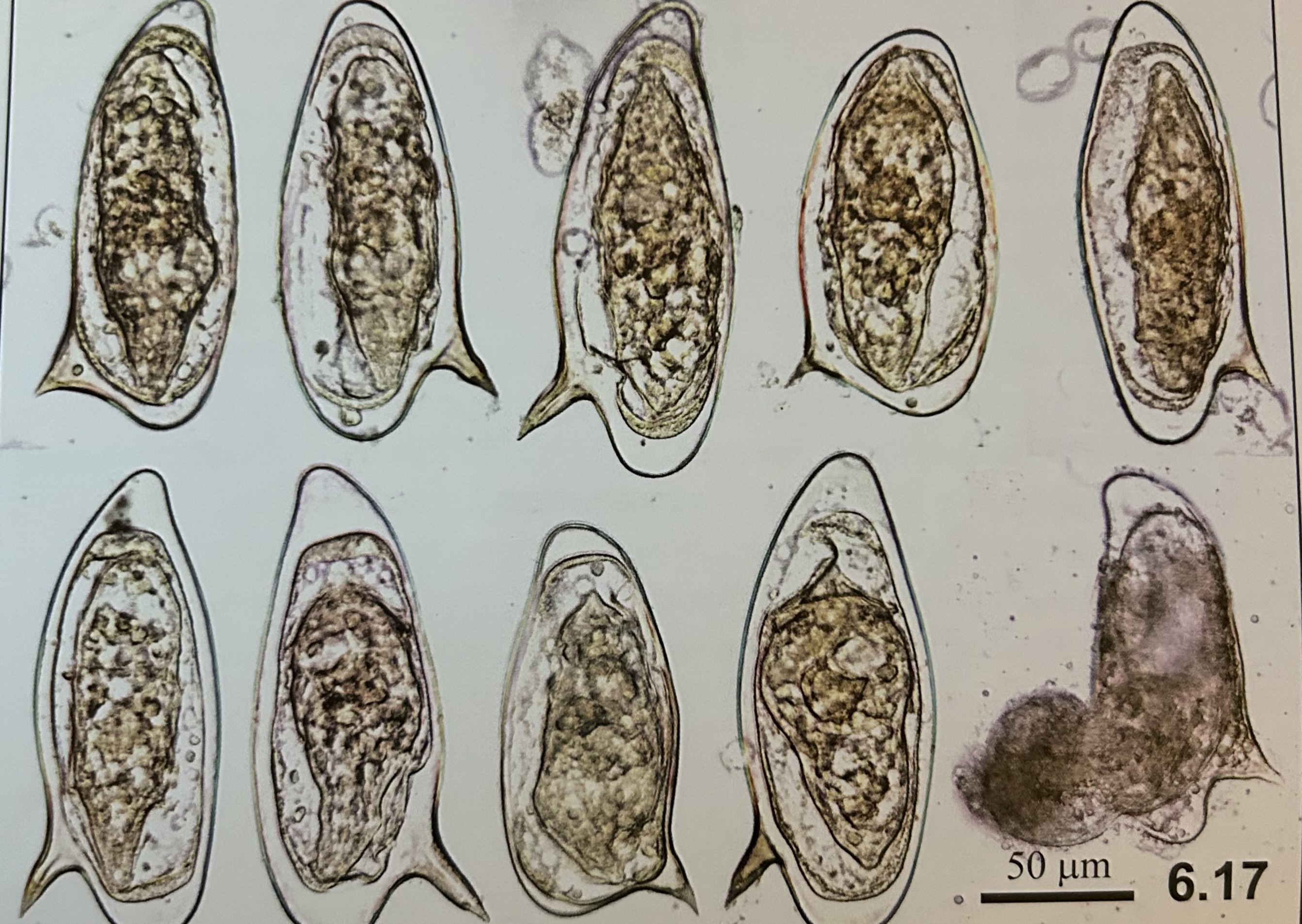 <p>structures of schistosoma mansoni (egg)?</p>