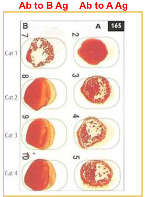 <p>Card contains lyophilized antiserum to the particular RBC antigen</p><p>Place 50 microliters of saline and 50 microliters of anticoagulated whole blood on an oval</p><p>Mix and rock one minute</p><p>Results: Cat 1 is type B, cats 2, 3, and 4 are type A</p>