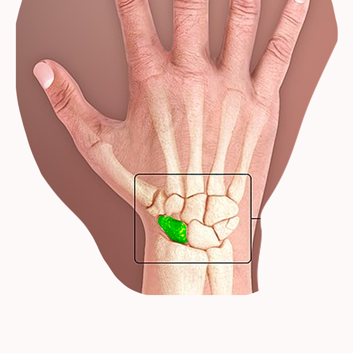 <p>Name the highlighted carpal</p>