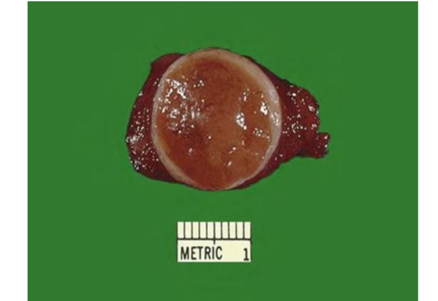 <p>Describe </p>