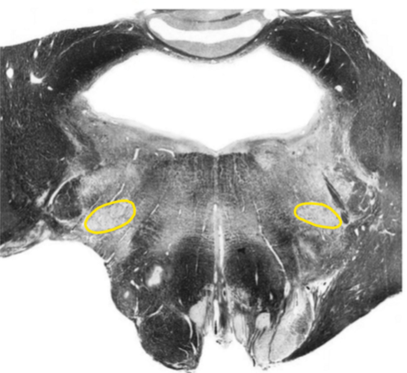 <p>ID the nucleus</p>