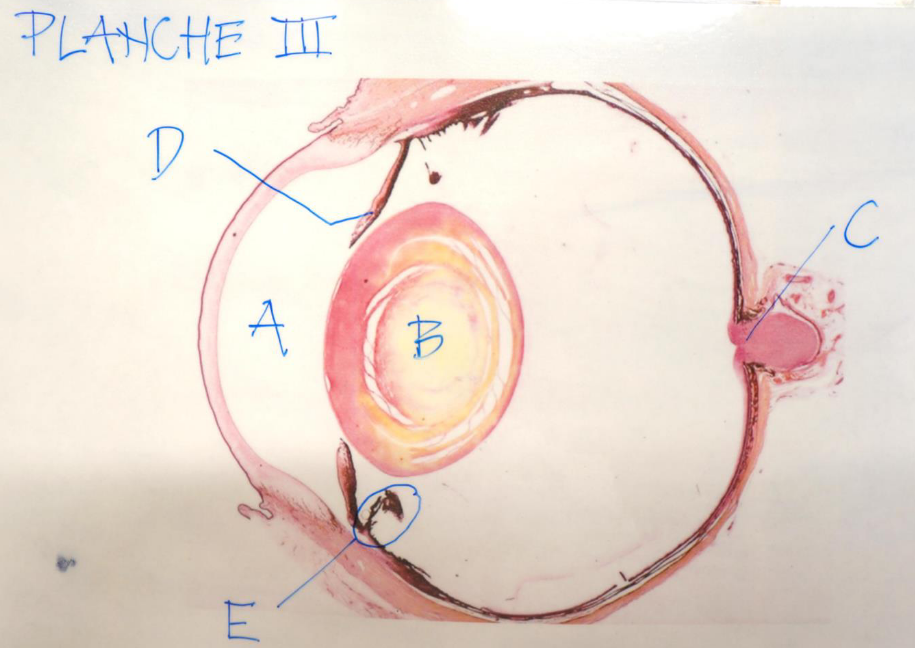 **Post 5.**

__Planche III: Histologisk billede af sanseorgan (Øje)__

\
**Spørgsmål 9:** Benævn strukturen B.