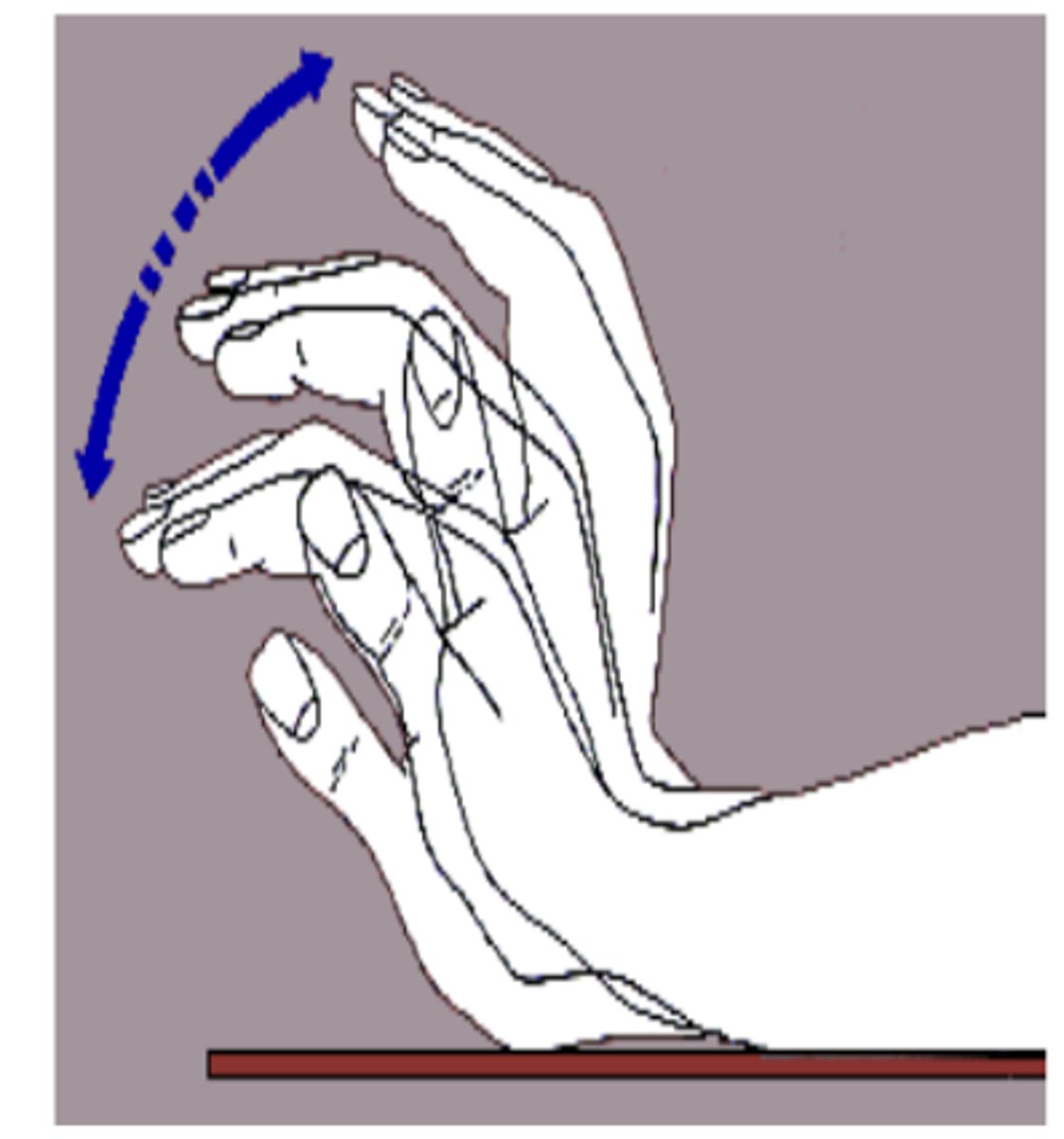 <p>-changes in personality, memory, concentration</p><p>-asterixis (liver flap)</p><p>-slurred speech</p><p>-hyperreflexia</p><p>-lethargy that can go to coma</p>