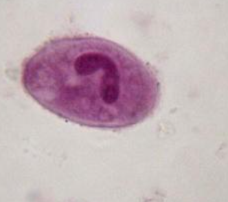 <p>Identify organism and stage</p>
