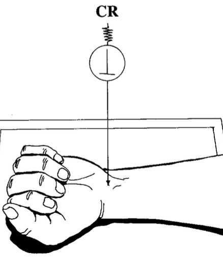 <p>AP wrist</p><ul><li><p>fist clenched </p></li></ul><p></p>