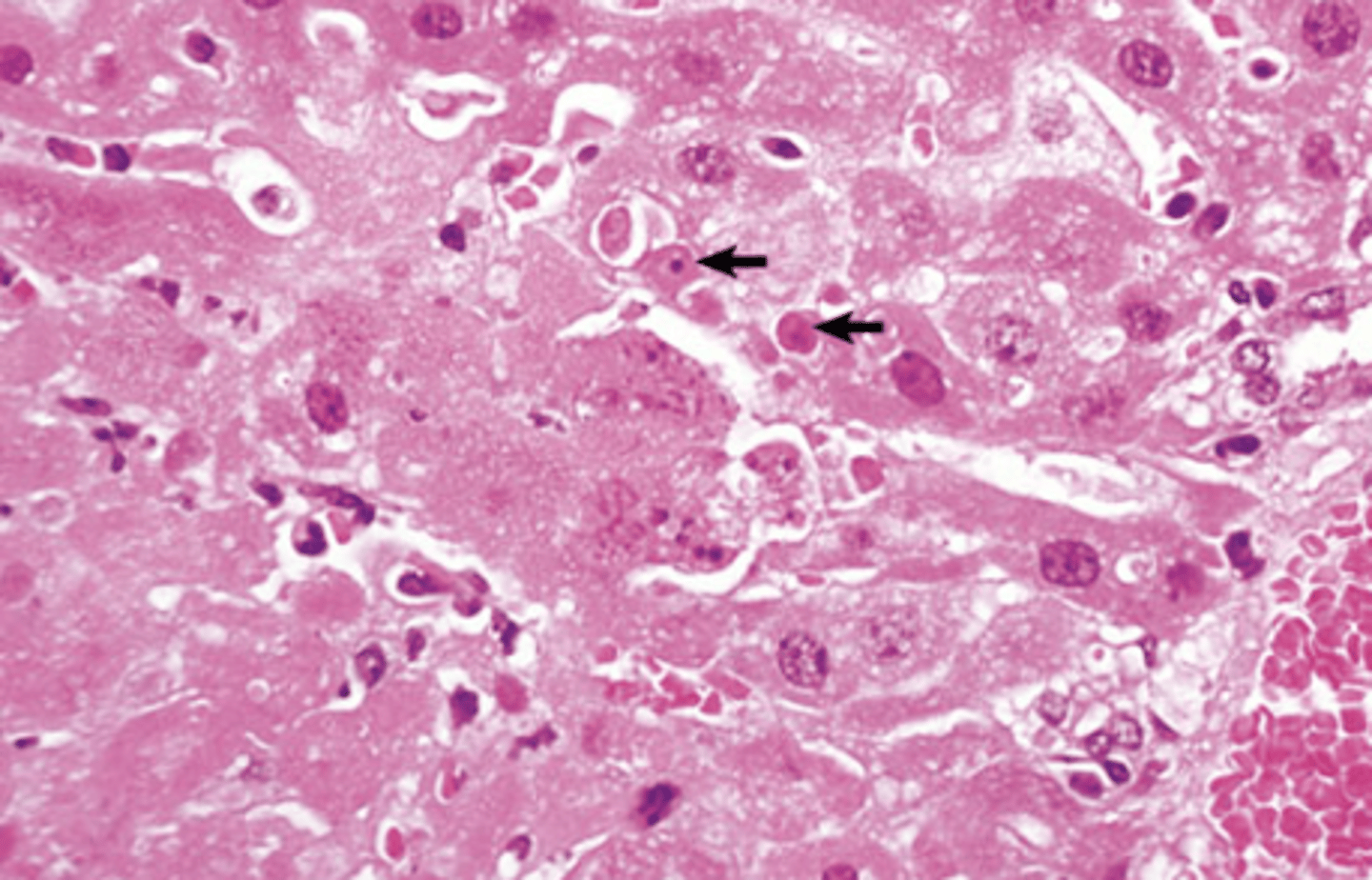 <p>What type of cell death is being shown in this image? Necrosis or apoptosis?</p>
