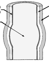 <p>what kind go aneurysm </p>