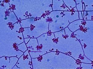 <p>Identify this fungi</p>