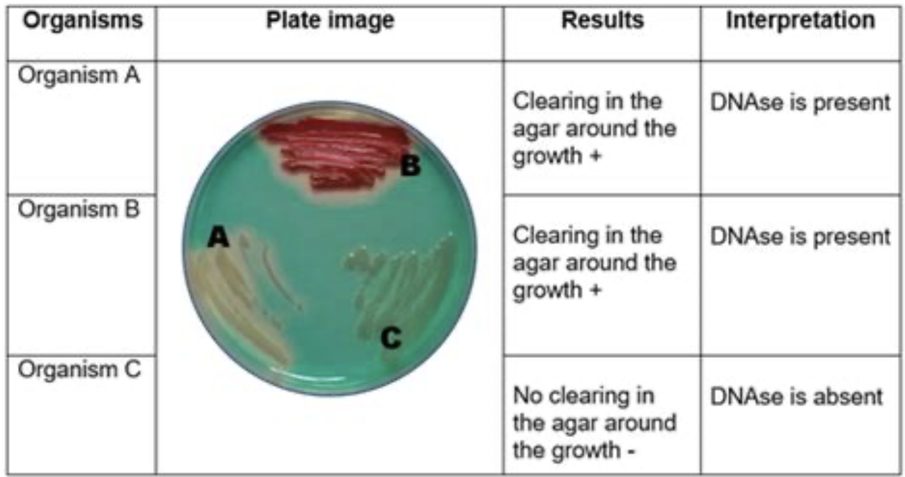 <p>DNase is absent</p>
