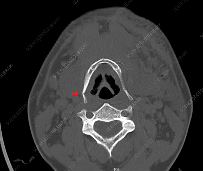 <p>What structure is the arrow pointing to</p>