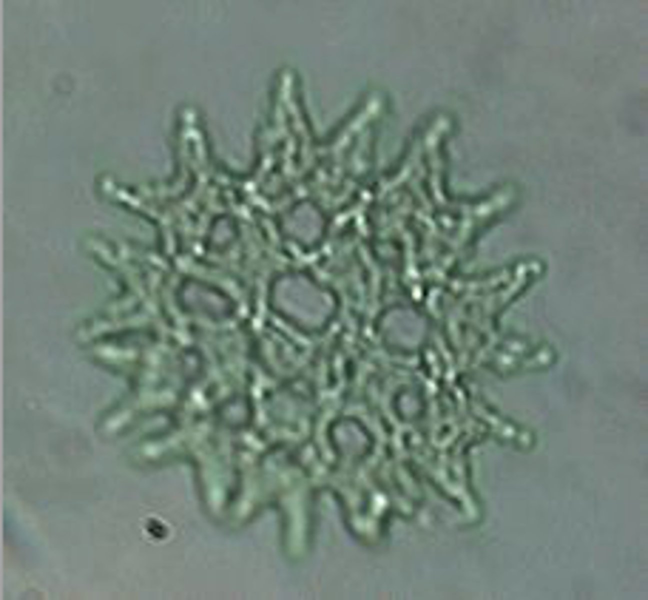 <p>Identify the Green alga shown</p>