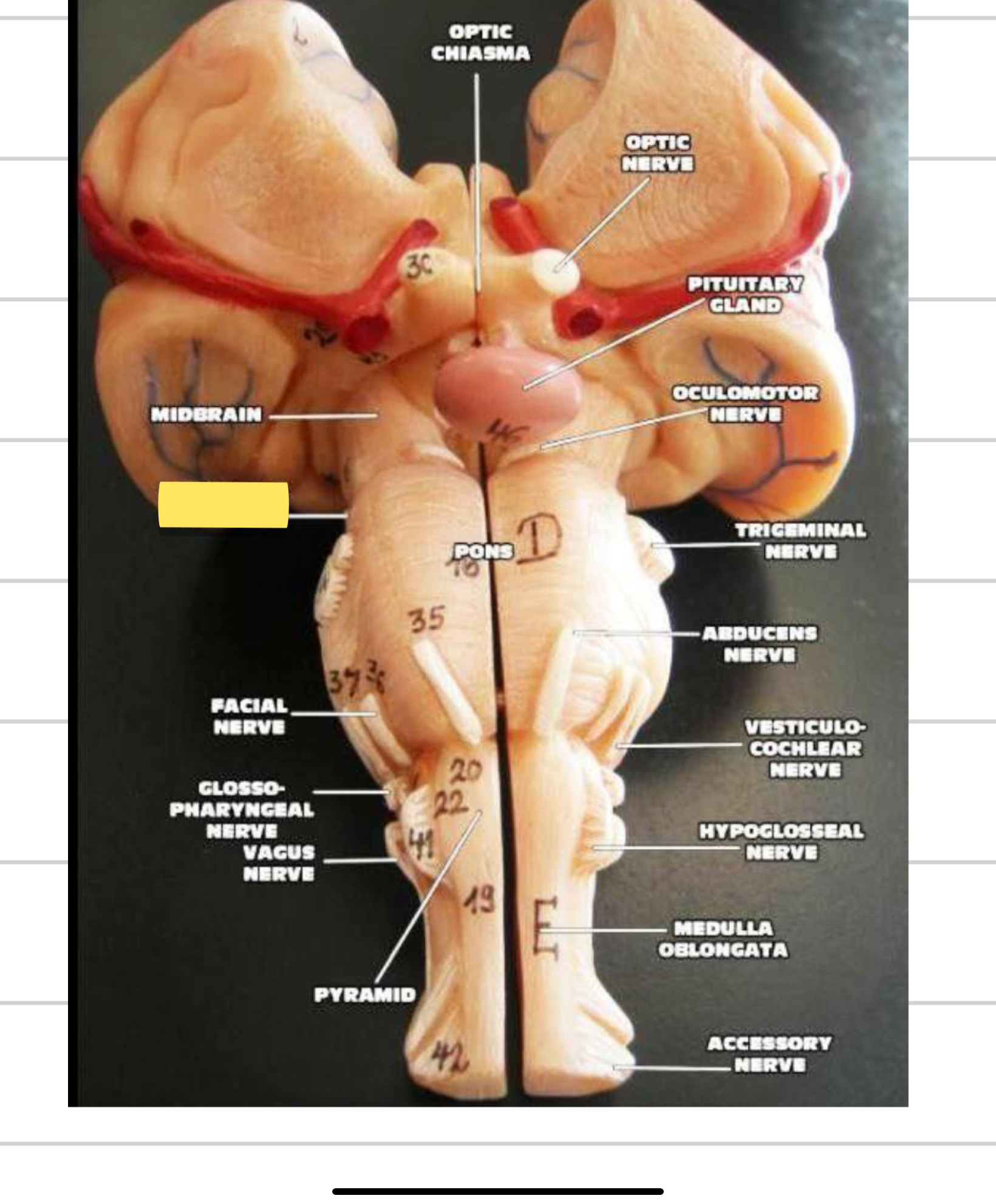 <p>Name this cranial nerve&nbsp;</p>