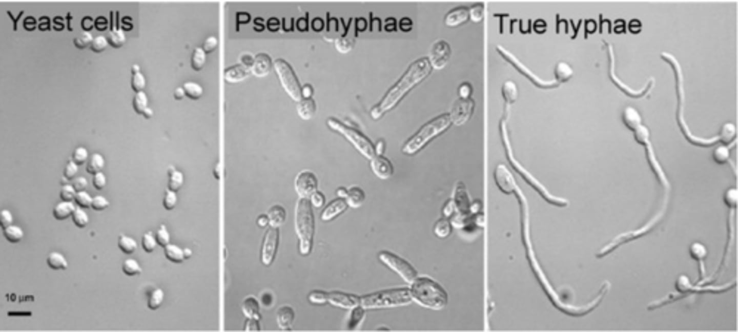 <p>the width of pseudohyphae cells is always larger than the hyphal cells</p>