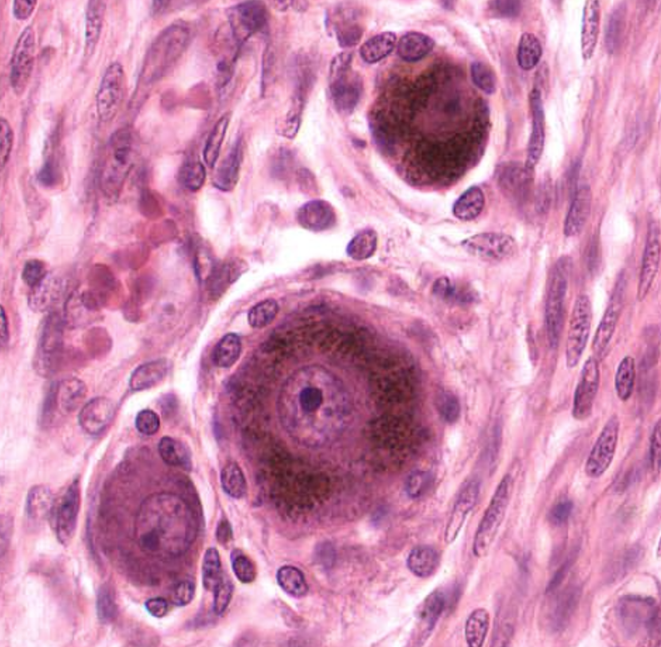 <p>which ganglion</p>