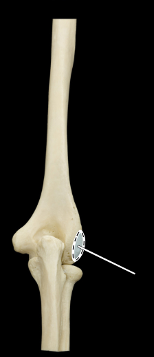 <p>Articulated humerus, ulna, and radius, posterior view</p>